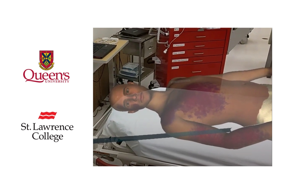 SLC and Queen's University logos are to the left of a picture of the virtual hologram patient
